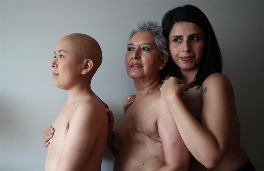 Lorena Estrada (i), Angeles Arreola (c) y Sandra Monrroy (d), pacientes con cáncer de mama, mientras posan en Ciudad de México (México). EFE