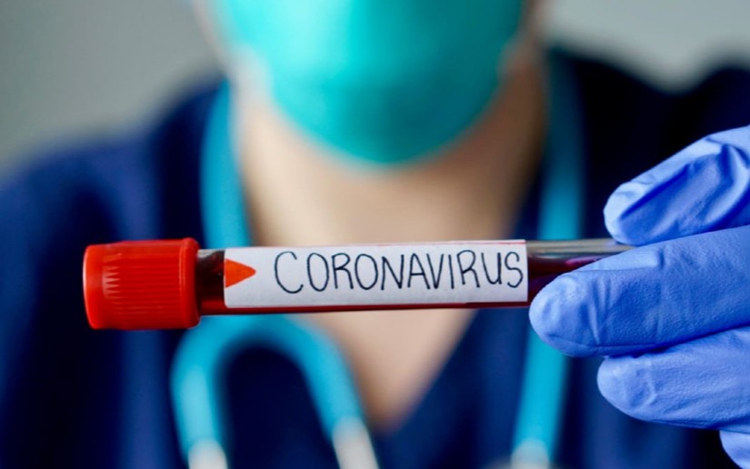 Nicaragua registra más de 6,500 casos de coronavirus, según el Minsa - Vos  TV