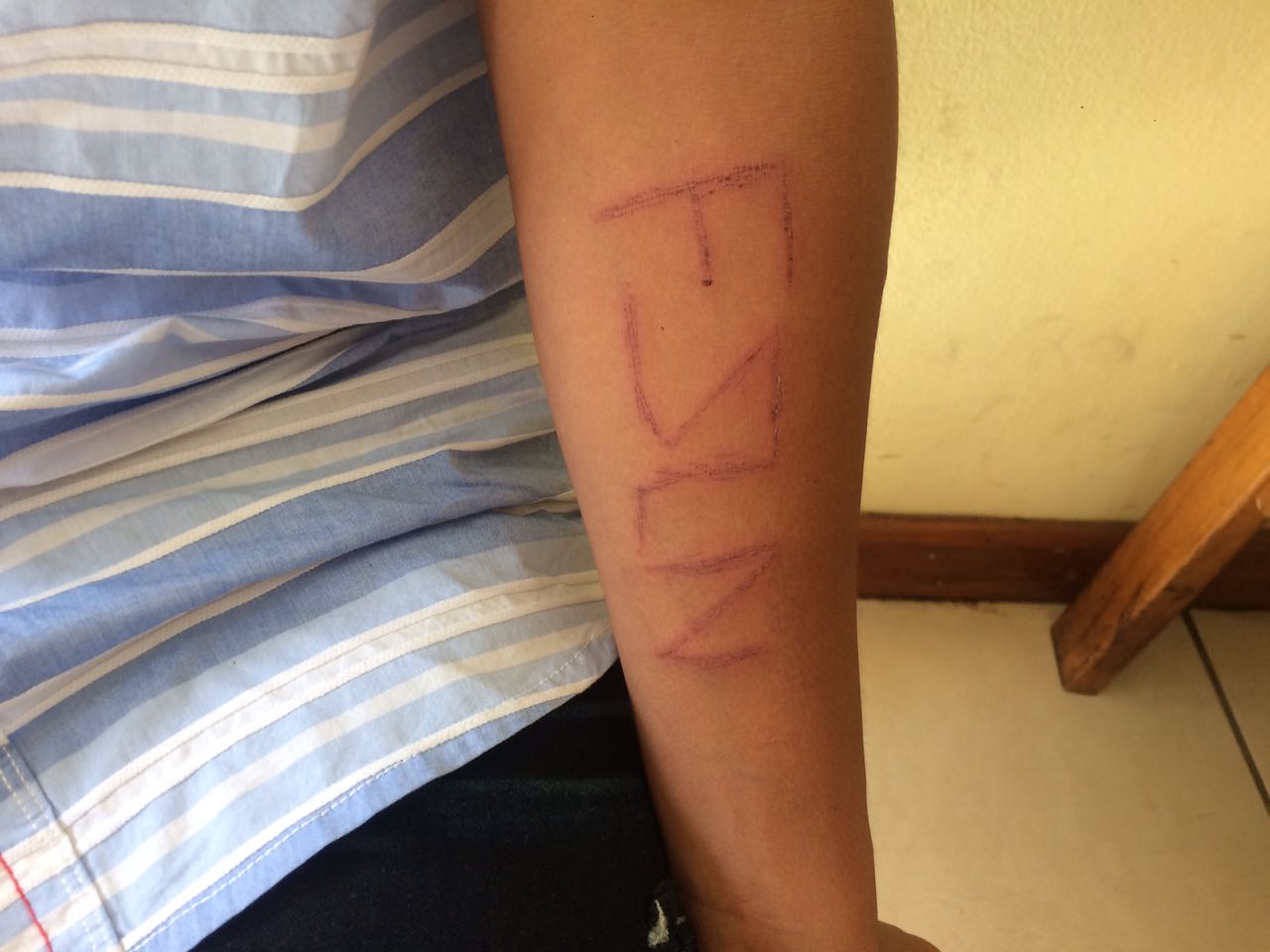 Según la denuncia, el menor fue golpeado y torturado. En su piel escribieron las siglas del FSLN. Foto: Walkiria Chavarría