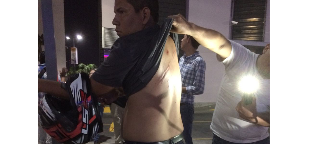 Este joven fue uno de las decenas de heridos registrados en las protestas de este miércoles. Foto: Gerall Chávez