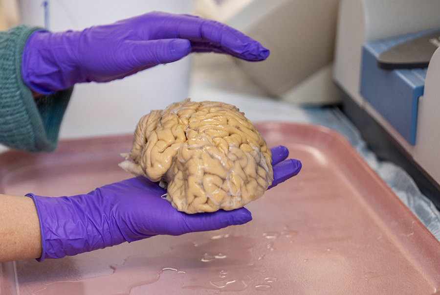Cerebro de un 'superanciano' donado en la Universidad Northwestern de Chicago, Illinois./ EFE