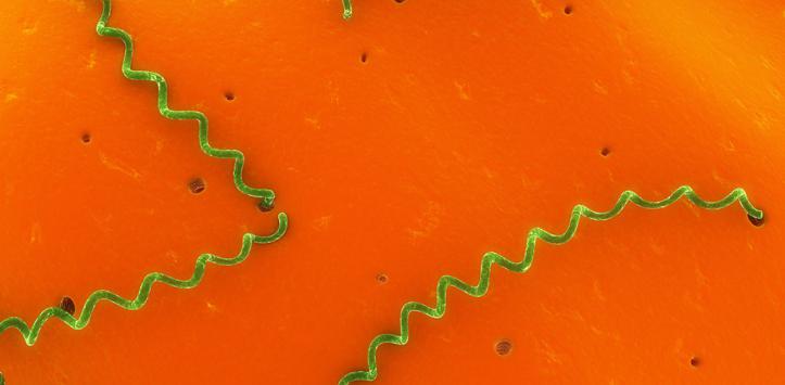 Leptospirosis vista desde microscópico. Foto: Web Consultas