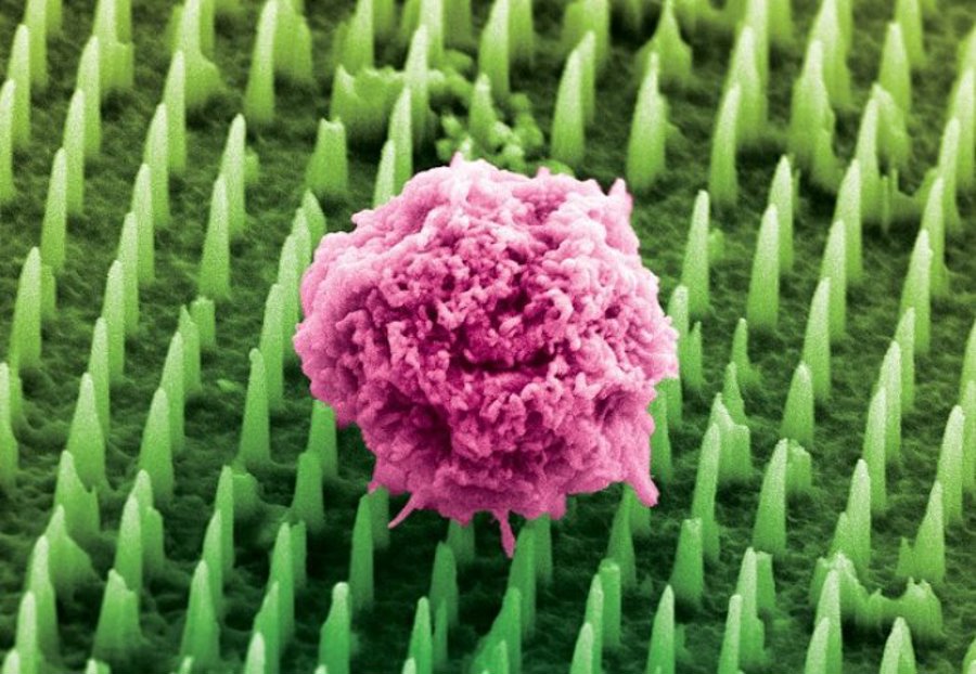 Imagen coloreada de nanoagujas. Crédito: Chippani/King's College London./ EFE