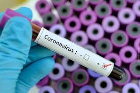 Costa Rica niega caso de Coronavirus / Cortesía