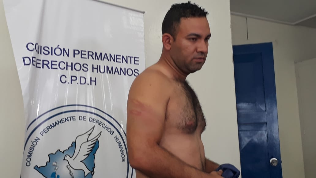 Manuel Herrera fue liberado junto a otras personas de Sébaco. 