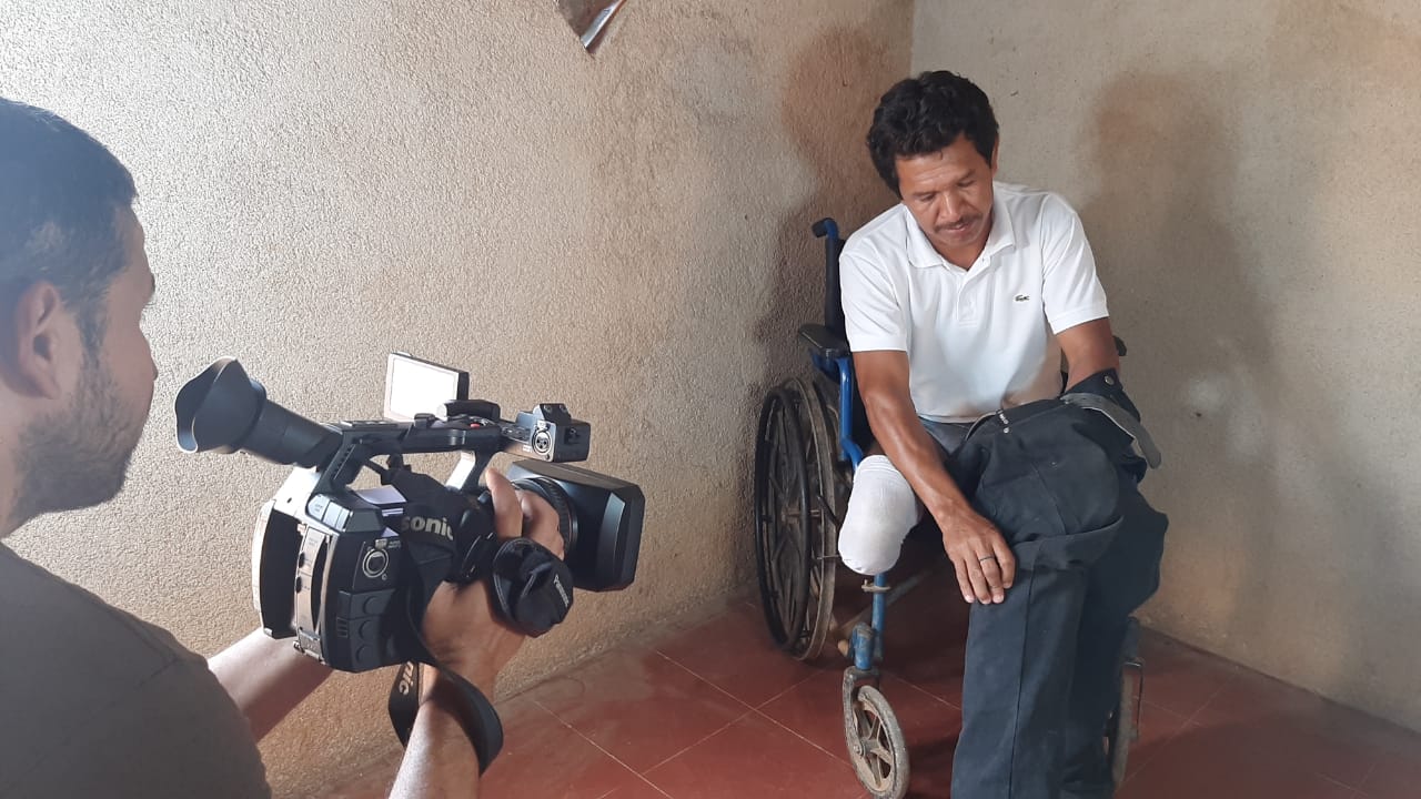 Dimas pasó dos años en silla de ruedas hasta que recibió una prótesis para sus piernas  